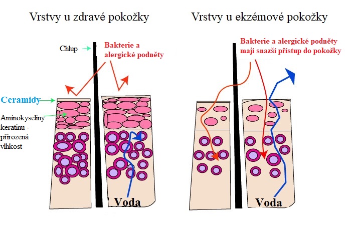 Ceramidy a další tuky jsou v pokožce hodně důležité