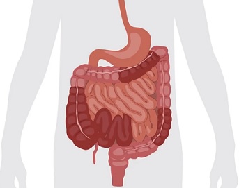 Zánětlivá střevní onemocnění (inflammatory bowel disease, IBD) představují skupinu chronických, imunitně podmíněných onemocnění postihujících primárně gastrointestinální trakt. Mezi tyto nemoci řadíme Crohnovu nemoc, ulcerózní kolitidu a tzv. indeterminovanou kolitidu.