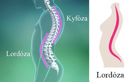 Takto vypadá lordóza.