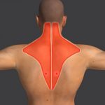 Spoušťové body (Trigger points) – co to je za body? Jak vám mohou pomoci?