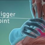 Masáž (samomasáž) spoušťových bodů – proč to dělat a jak na to?