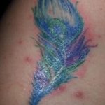 Akné na tetování – je to nebezpečné? Jak na něj?