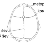 Kraniosynostóza – co je to – příznaky, příčiny a léčba