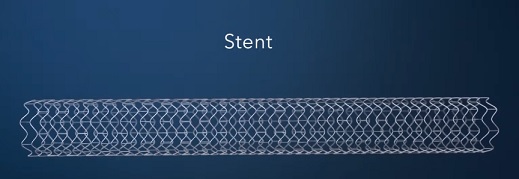 Stent