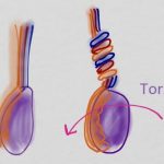 Torze varlat – co je to – příznaky, příčiny a léčba