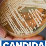 Superkvasinka Candida auris – co to je – příznaky a léčba