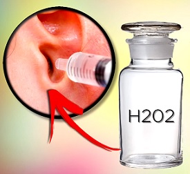 Dá se peroxid vodíku použít na vyčištění uší?