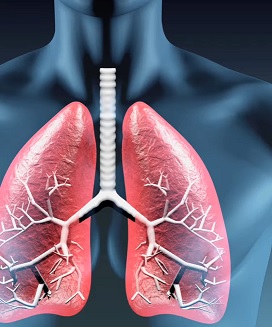 Transplantace plic je operace, která nahradí nemocnou nebo selhávající plíci plícemi zdravého dárce.