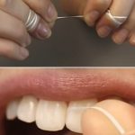 Jak správně používat zubní (dentální) nit? Většina lidí to neumí!