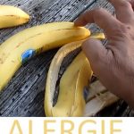Alergie na banány – příznaky a léčba – co je dobré vědět