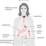 Amyloidóza – co je to – příznaky, příčiny a léčba