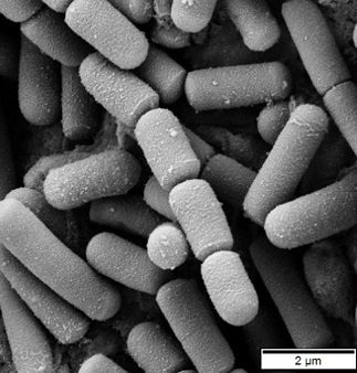 Bacillus cereus pod mikroskopem