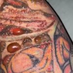 Alergie na tetování – příznaky, příčiny a léčba