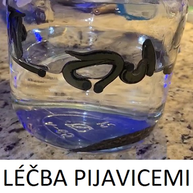 Jaké účinky má léčba pijavicemi lékařskými?