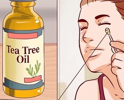 Čajovníkový olej (tea tree) na bradavice - jak a proč použít?