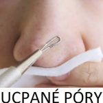 5 nejlepších rad na ucpané póry