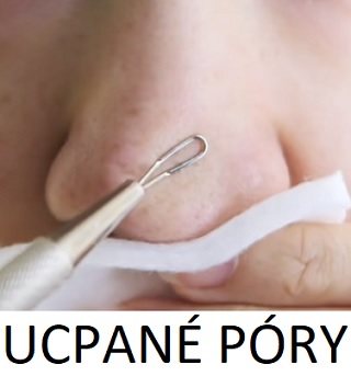 Jak na ucpané póry