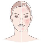 Toto jsou příčiny suché kůže + jak se suchá kůže léčí