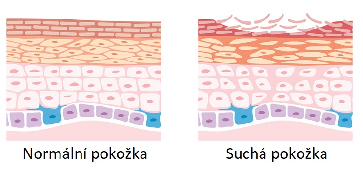 Normální pokožka vs. suchá pokožka