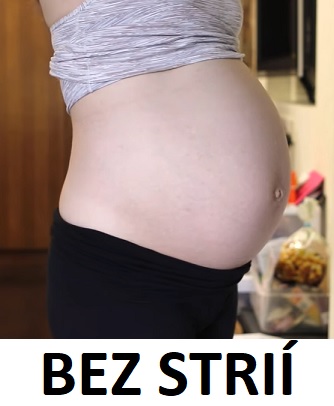 Strie netrápí pouze těhulky. Vytváří se, když tělo rapidněji roste při těhotenství.