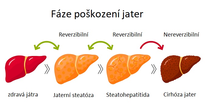 Fáze poškození jater