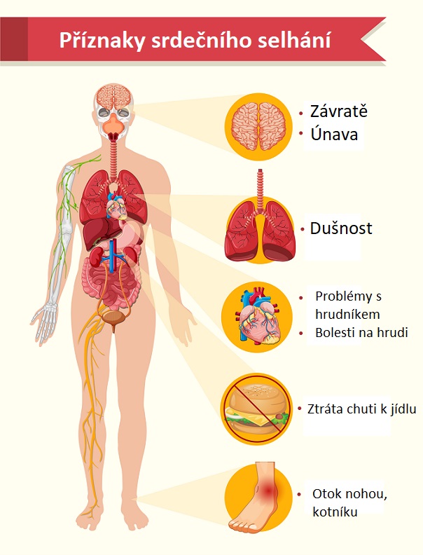 Příznaky srdečního selhání