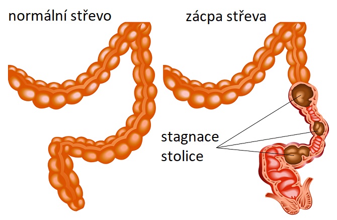 Infografika - zácpa