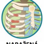 Naražená (pohmožděná) žebra – příznaky, příčiny a léčba