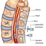 Spinální anestezie – co je to a kdy se používá