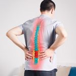 Spondylartróza – co je to – příznaky, příčiny a léčba