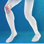 Gonartróza (artróza kolenního kloubu) – příznaky, příčiny a léčba