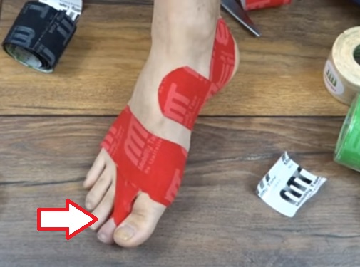 Kinesiotaping na kladívkové prsty