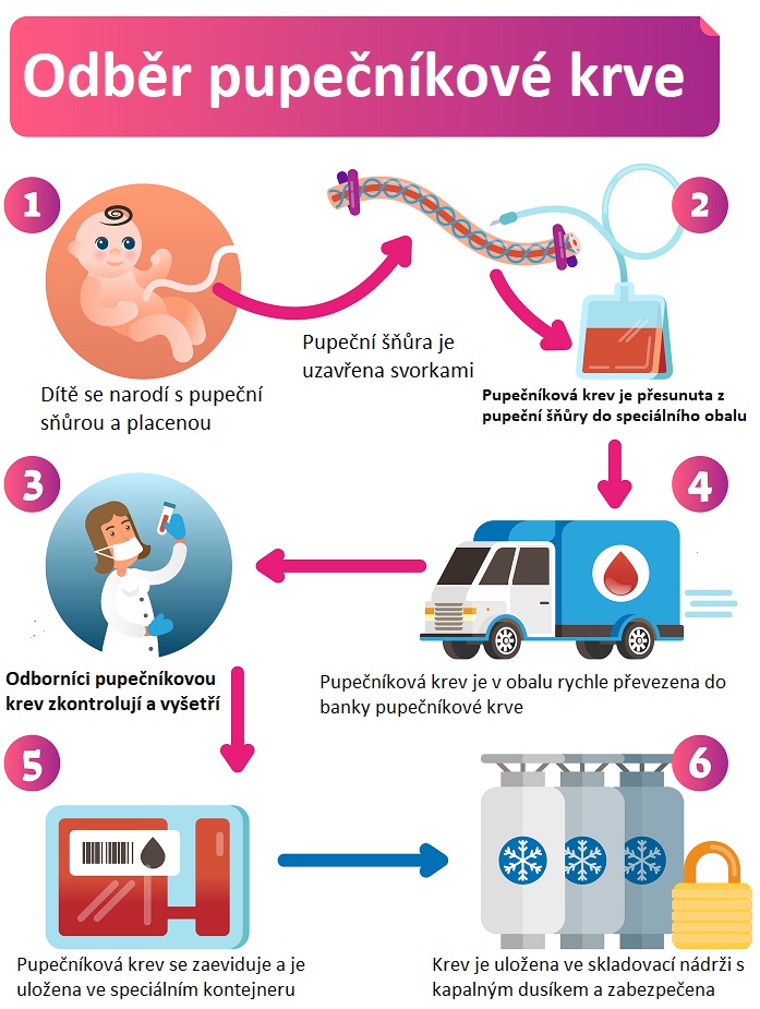 Odběr pupečníkové krve - ilustrace
