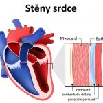 Myoperikarditida – zánět srdce (myokardu) a osrdečníku (perikardu) současně – příznaky, příčiny a léčba