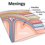 Meningeom na mozku – co je to – příznaky, příčiny a léčba