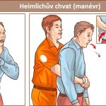 Heimlichův chvat (manévr) – co je to a kdy se používá?