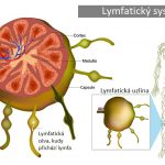 Lymfadenektomie (odstranění lymfatických uzlin) – co je dobré vědět – kdy, proč jak?