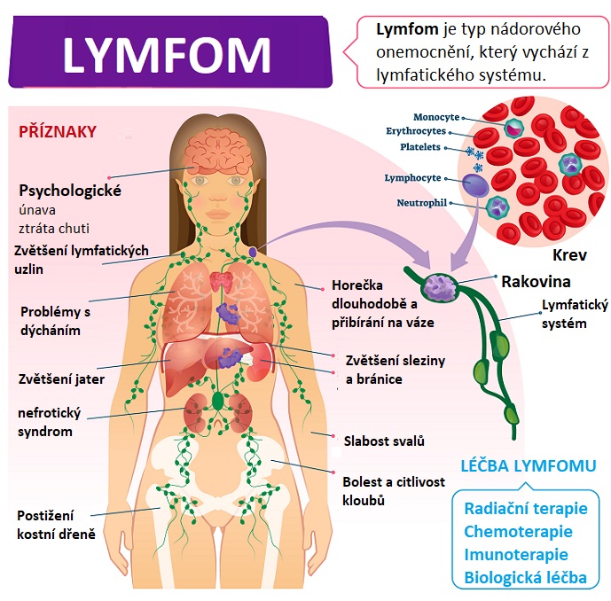 Lymfom - ilustrace