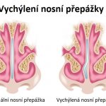 Septoplastika – co je to a kdy se používá?