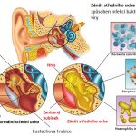 Zánět středního ucha – co je dobré vědět – příznaky, příčiny a léčba