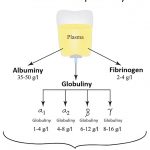 Hypoalbuminémie – co je to? Příznaky, příčiny a léčba