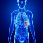 Rakovina sleziny – příznaky, příčiny a léčba