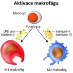 Syndrom aktivovaných makrofágů – příznaky, příčiny a léčba