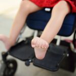 Spasticita a její léčba – jaké jsou příčiny spasticity?