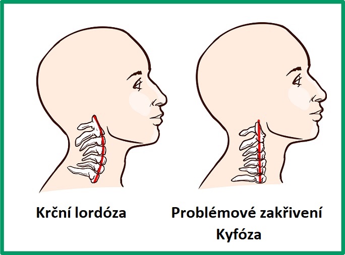 Krční lordóza a kyfóza - ilustrace