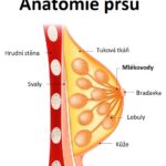 Intraduktální papilom – nádory v mlékovodech prsu – příznaky, příčiny a léčba