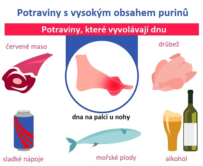 Potraviny s vysokým obsahem purinů - ilustrace