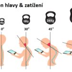 Textový či SMSkový krk – co je to a jak na něj?