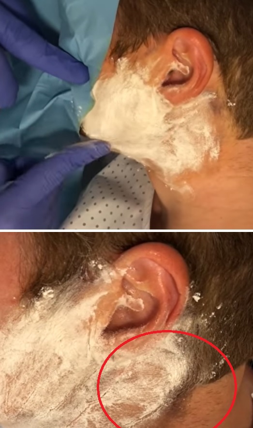 Minorův test - průběh a výsledek