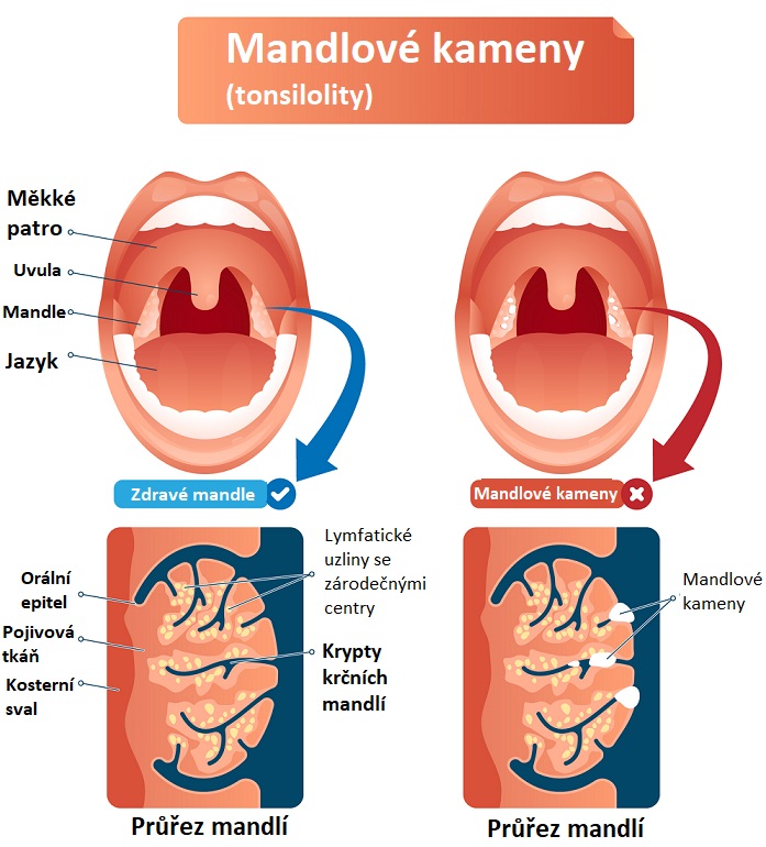 Mandlové kameny - ilustrace